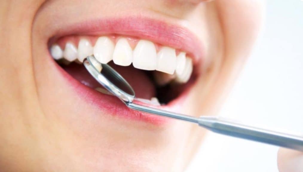 Clareamento dos dentes