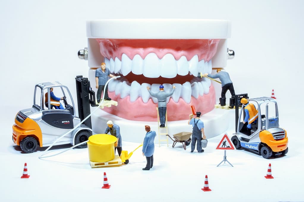 Lente Dental