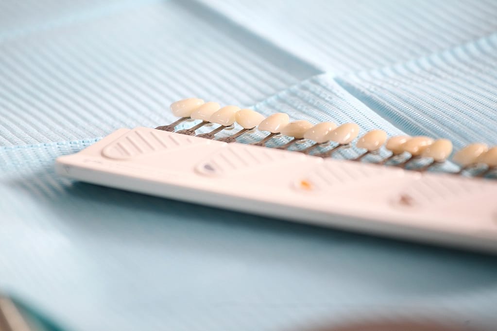Cores da Lente de Contato Dental
