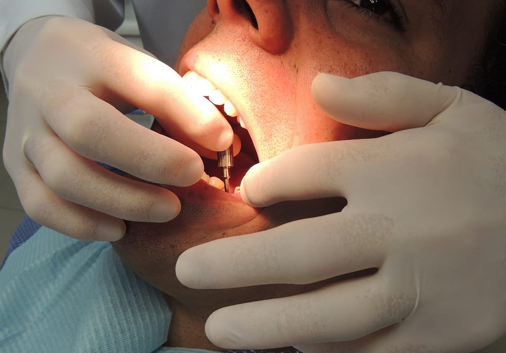 Ajuste de Prótese de Implante de Dentes
