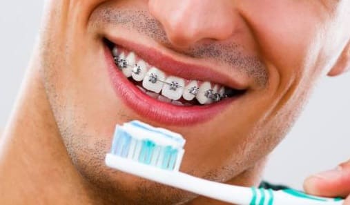O que é ortodontia e quais tratamento ela abrange? Vamos te contar tudo! -  Barini Odontologia